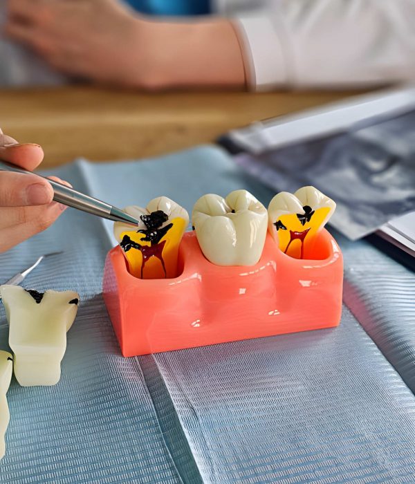 Full & Partial Dentures to Replace Missing Teeth 1